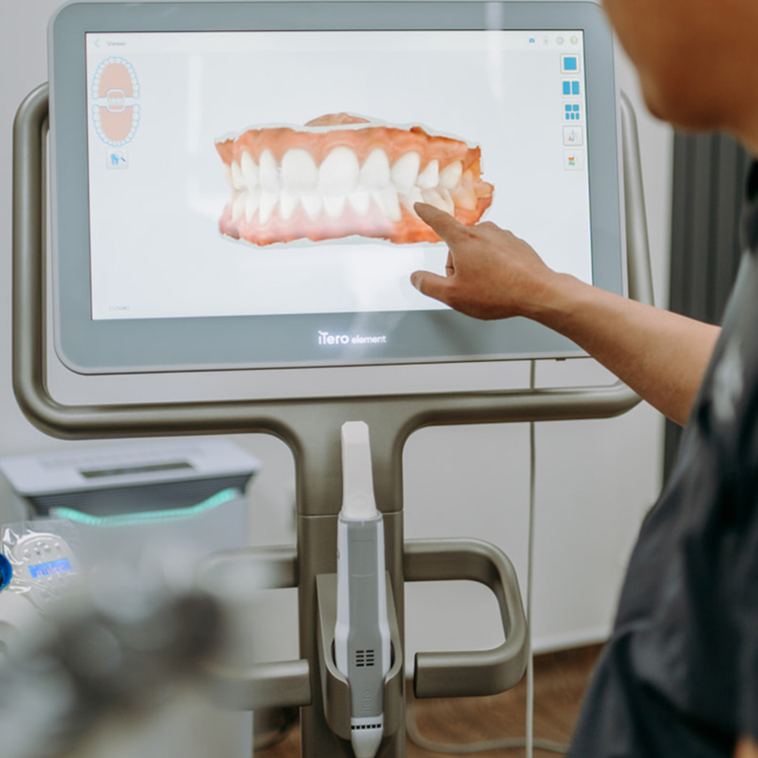 Invisalign-dulwich-dentist-1
