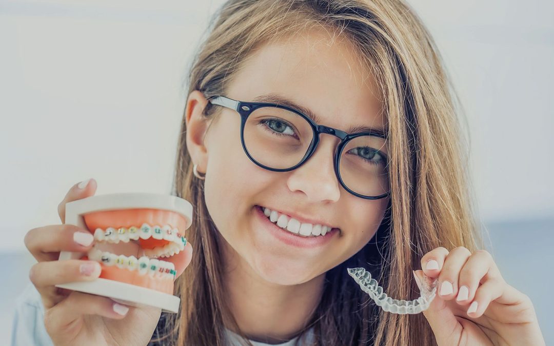 Teeth Straightening Options for Teens