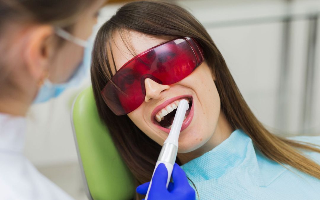 The Benefits of Professional Teeth Cleaning